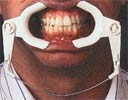 adjustablecheek.jpg